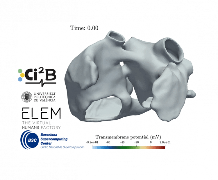 atrial-electromechanical-modeling-for-in-silico-assessment-of-atrial-fibrillation-therapies