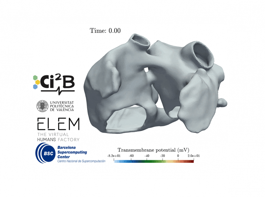 atrial-electromechanical-modeling-for-in-silico-assessment-of-atrial-fibrillation-therapies